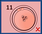 EmbryoScope