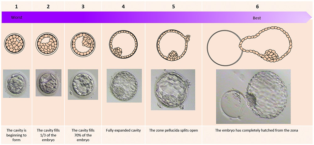Degree of cavity expansion