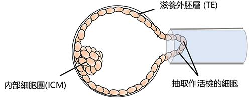 囊胚細胞活檢 